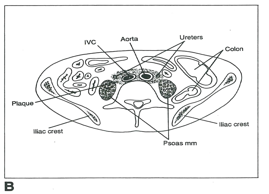 図1B