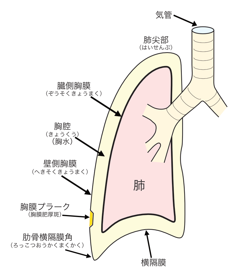 3 胸膜プラーク 胸膜肥厚斑 出来やすい部位